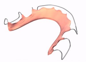 Hawley Retainer2