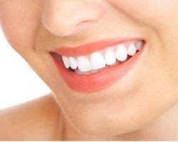Tooth Whitening