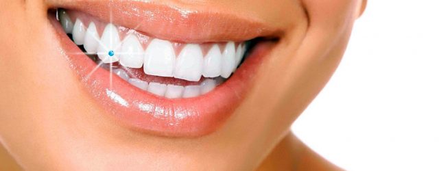 gigi estetika jakarta klinik Joy Gigi  gigi Dental Klinik syaraf Yogyakarta