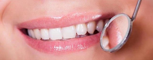 perawatan saraf gigi klinik gigi dental yogyakarta perawatan saraf gigi klinik gigi dental yogyakarta
