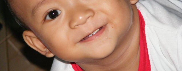 Tinggi, Kasus Karies pada Anak Balita