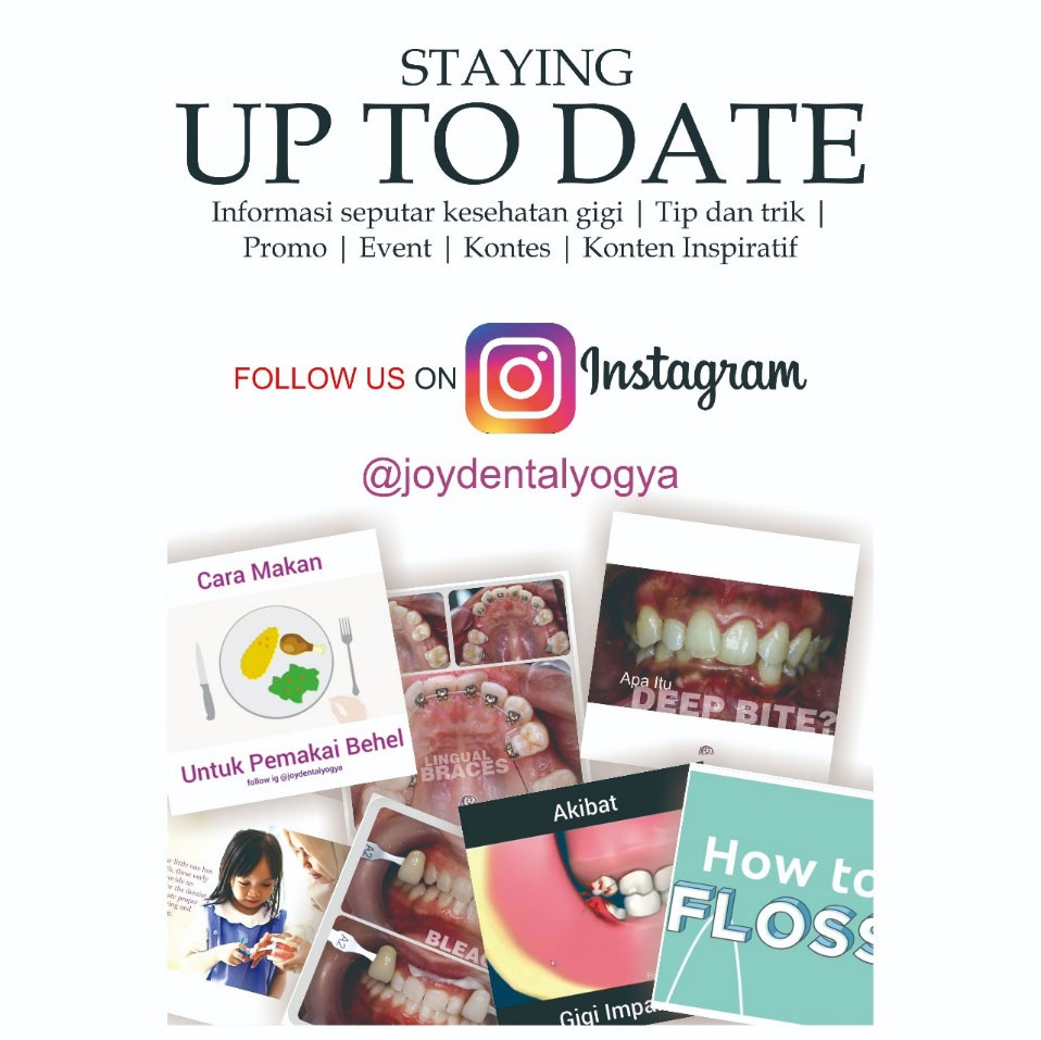 follow instagram joy dental