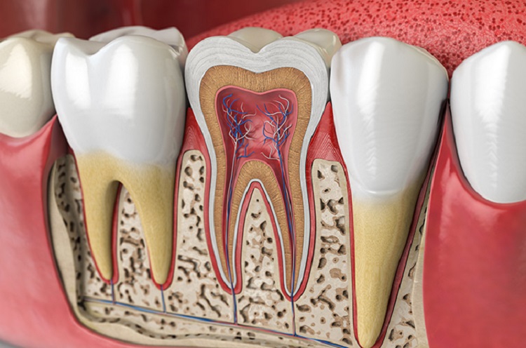 Dentin yang terbuka dapat meningkatkan sensitivitas gigi, Sumber: halodoc.com