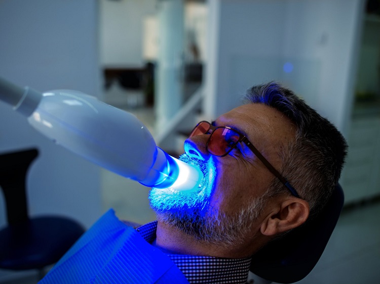 Ilustrasi tindakan teeth whitening di dokter gigi, Sumber: menshealth.com
