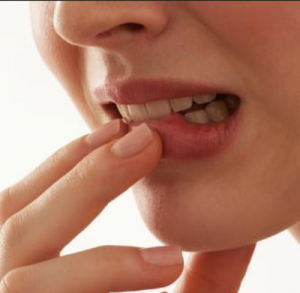 Waspadai Diabetes mellitus pada gigi goyah