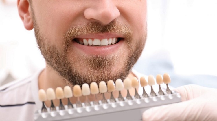 Bleaching gigi membuat tingkat kepercayaan diri meningkat, Sumber: northsydneydentalpractice.com.au