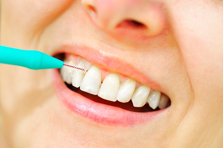 Membersihkan sela gigi dengan sikat interdental, Sumber: tabloidbintang.com