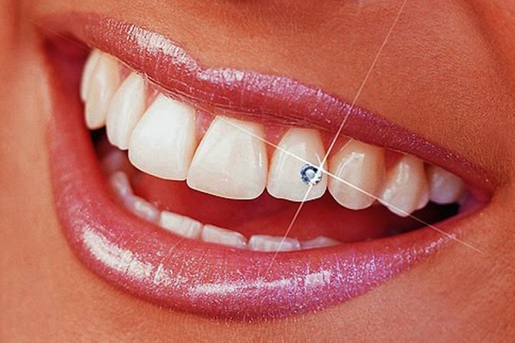 Mengenal lebih dekat dengan perhiasan gigi, Sumber: dictio.id