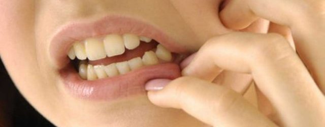 Panduan: 7 Cara Mudah Merawat Gigi Sensitif dan Ngilu