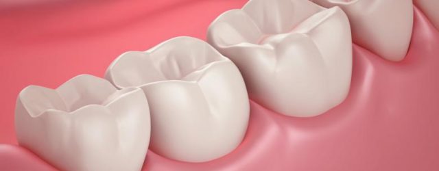 CAMBRA, Metode untuk Deteksi Gigi Berlubang