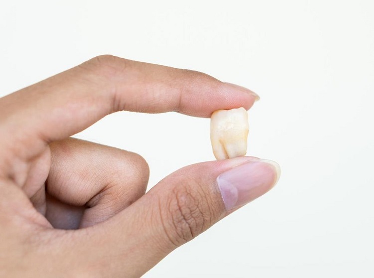 Informasi terkait gigi yang lepas sendiri tiba-tiba, Sumber: detik.com