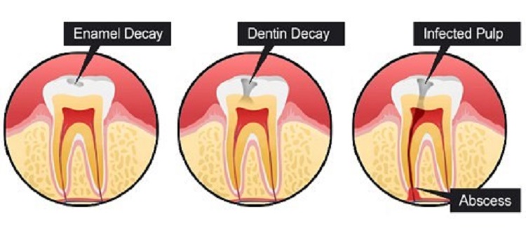 Komponen-komponen pada gigi, Sumber: klinikjoydental.com