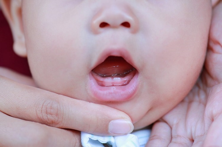 Gigi susu yang sedang tumbuh pada bayi, Sumber: today.uconn.edu