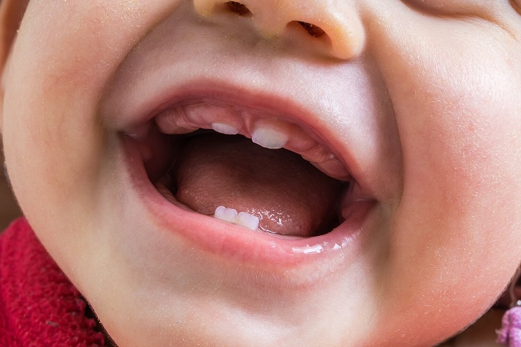 Mengenal cara merawat gigi susu, Sumber: thefoleckcenter.com