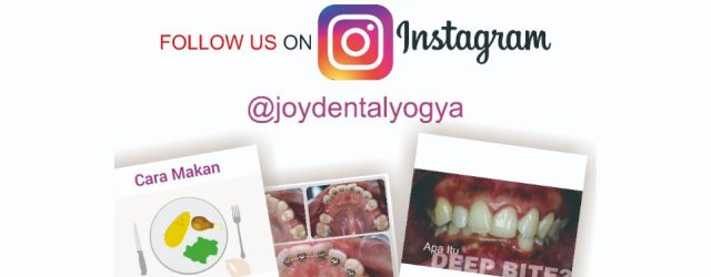 5 Alasan kenapa kamu harus follow ig @joydentalyogya