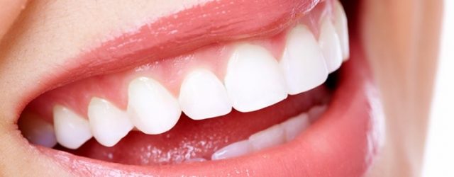 Memutihkan gigi dengan bleaching “Flash Whitening System”