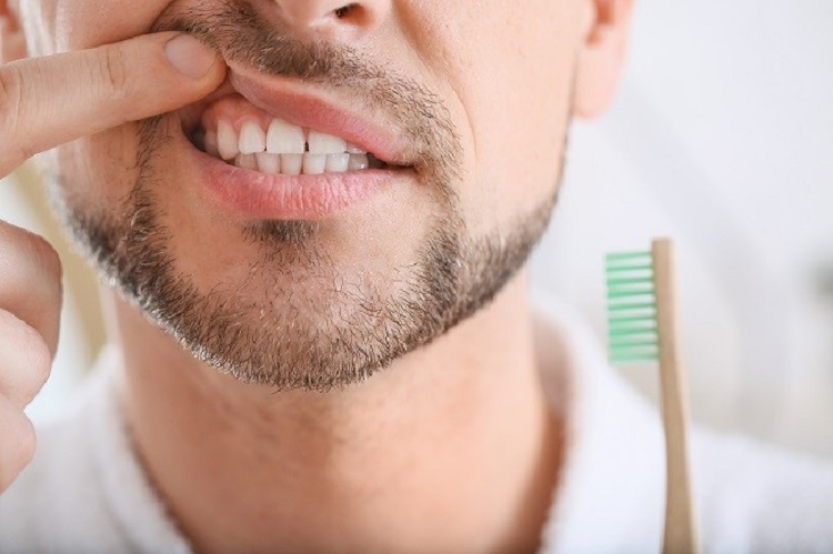 Menyikat gigi yang benar dapat meminimalisir gusi bengkak, Sumber: alodokter.com