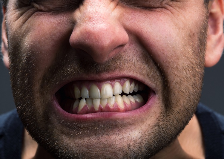 Kebiasaan bruxism dapat merusak gigi, Sumber: complicated.life