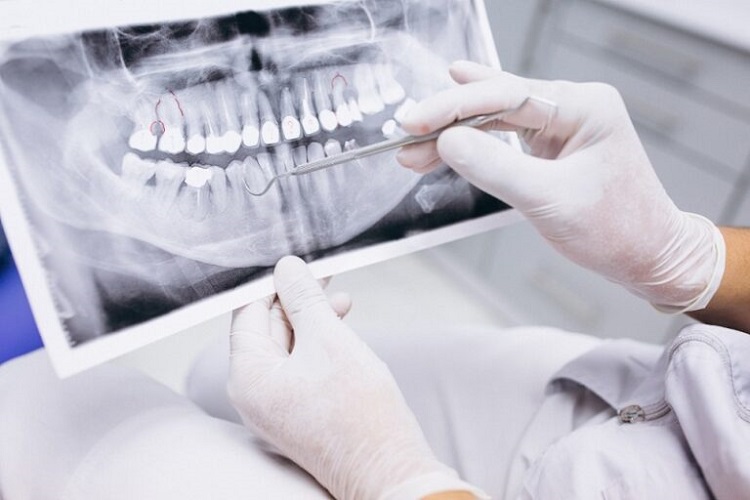Dokter sedang menganalisis rontgen gigi pasien, Sumber: damessa.id