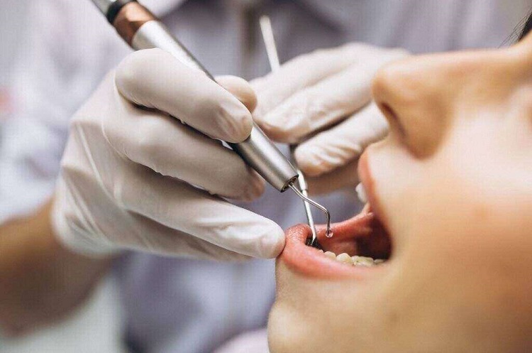 Proses mematikan saraf gigi, Sumber: doktersehat.com