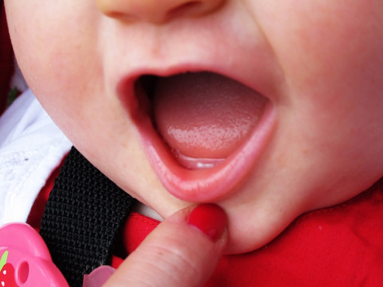 Gusi terasa gatal juga dialami oleh bayi ketika akan tumbuh gigi, Sumber: review.bukalapak.com
