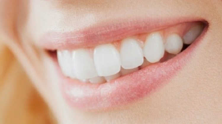 Indahnya warna gigi putih alami ketika tersenyum, Sumber: jogja.tribunnews.com