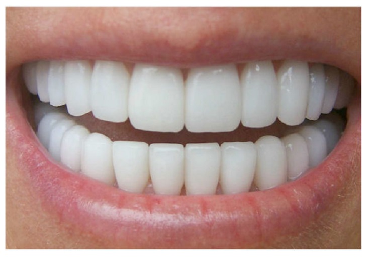 Ilustrasi gigi yang rapi dan sehat, Sumber: idntimes.com