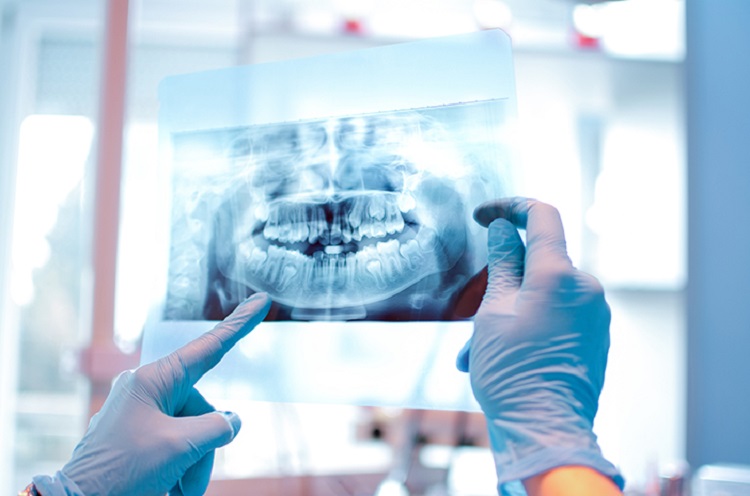 Dokter sedang memeriksa kondisi gigi dari hasil rontgen, Sumber: halodoc.com