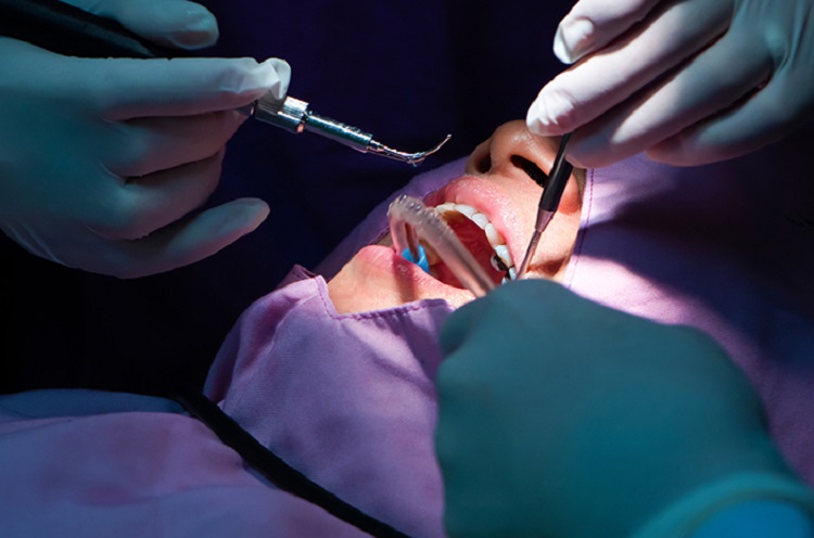 Melakukan perawatan kuretase gigi di dokter gigi profesional, Sumber: halodoc.com