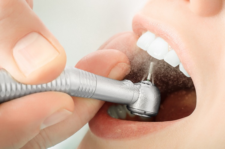 Mengenal lebih dekat dengan metode kuretase gigi, Sumber: hdmall.id