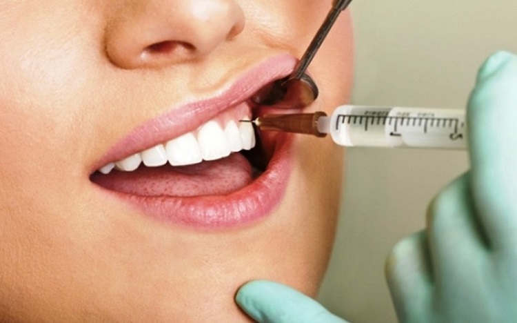 Terdapat berbagai jenis obat bius gigi, Sumber: dictio.id