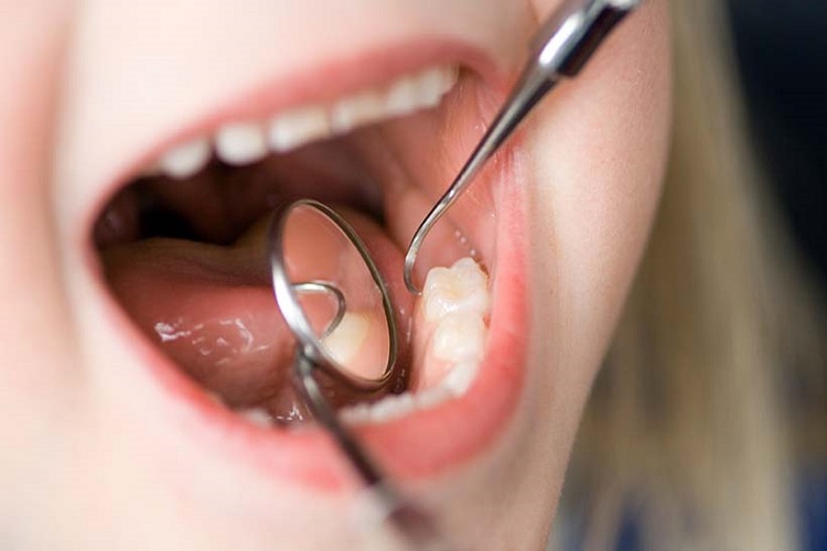 Mengatasi gigi geraham sakit dengan dokter gigi profesional, Sumber: victoryplazadental.com
