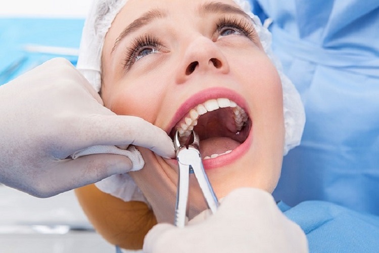 Prosedur cabut gigi di klinik gigi profesional, Sumber: bedahmulut.com