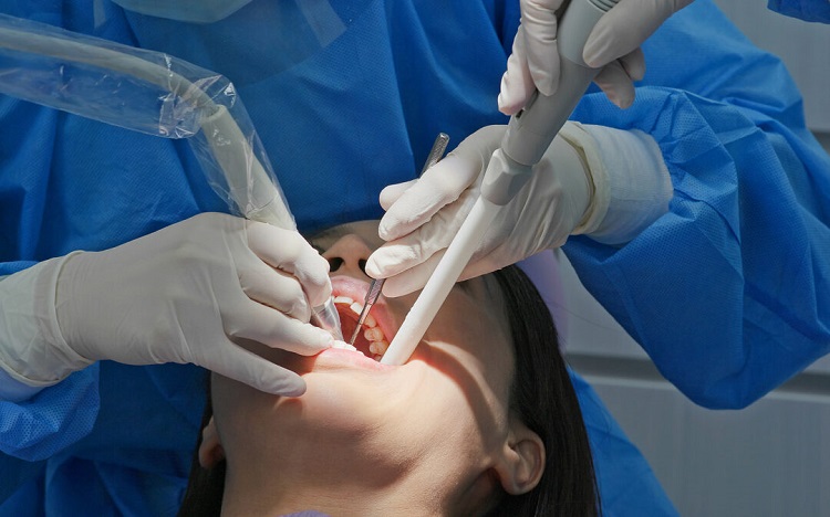 Proses scaling gigi yang dilakukan oleh dokter gigi profesional, Sumber: hovedentalclinic.co.uk