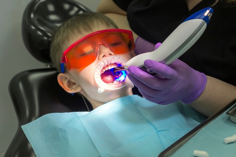 Tambal gigi menggunakan metode laser, Sumber: parkmeadowsdental.ca