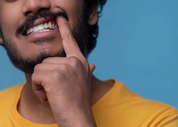 cara merawat gusi agar tetap sehat