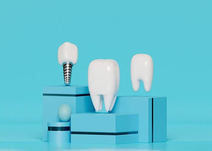 how dental implants work